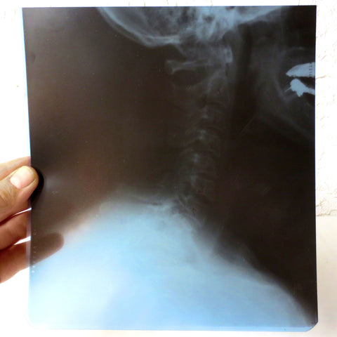 Vintage Genuine Medical X-Ray 8X8" of a Patient's Neck Cervical Vertebrae and Skull, Human Skeleton X-Ray, Thick Blue Plastic Sheet